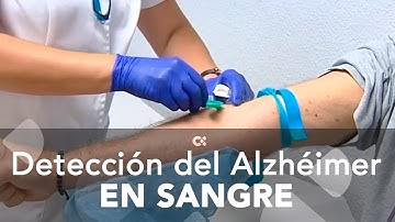 Una nueva técnica diagnóstica detecta el Alzhéimer en sangre