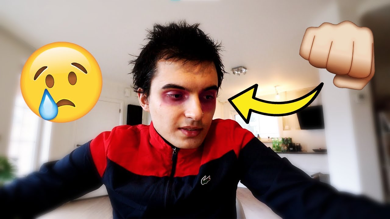 ik word lastig gevallen & heb een blauwe oog... # vlog 2
