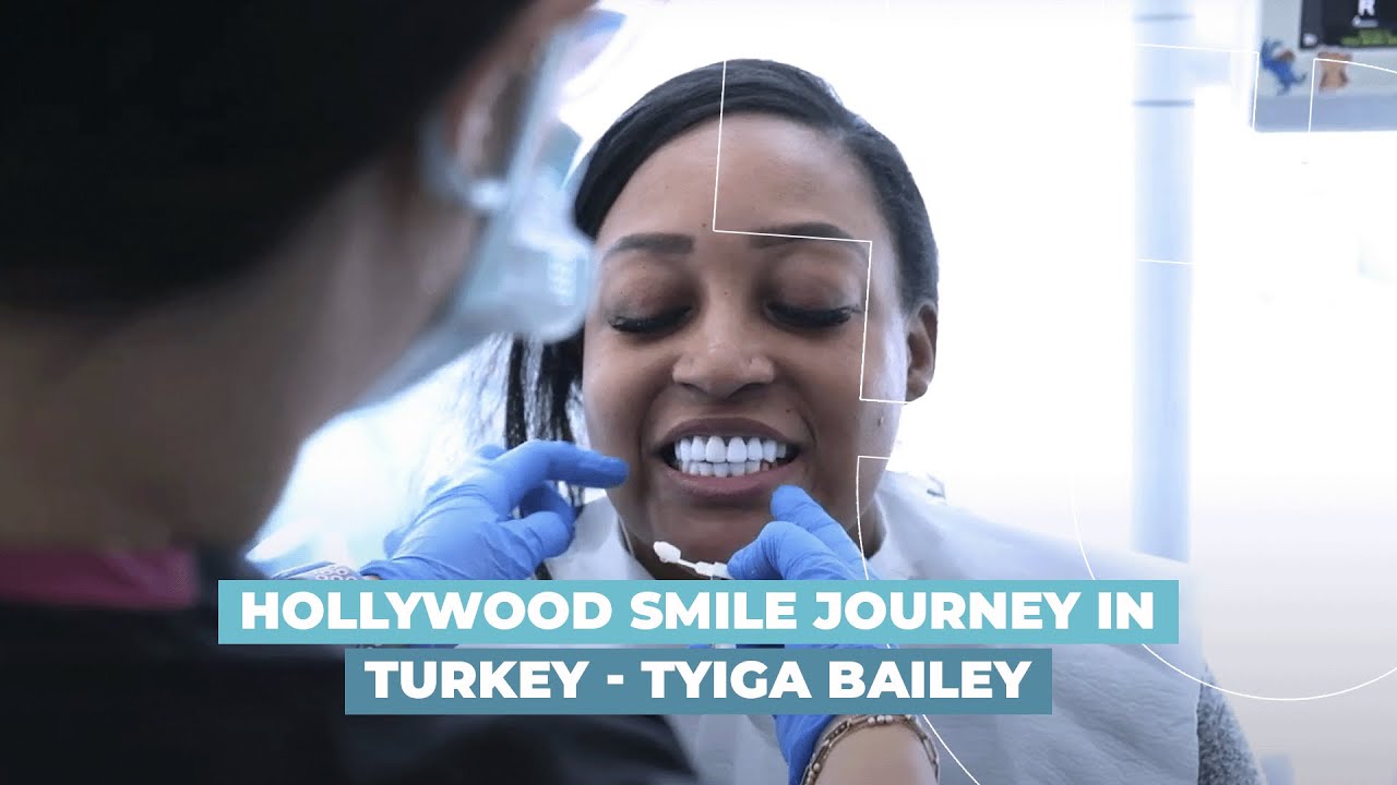 Hollywood Smile Journey in Turkey - Tyiga Bailey