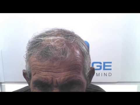 ავთანდილ სოყურაშვილი ჯანმრთელობის პრობლემის შესახებ