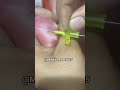 Iv cannula insertion in hand #medicoworld #clinicalskills #ivcannula #medicalreels #bloodsampling