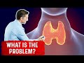 Hypothyroidism May Not Be a Thyroid Problem