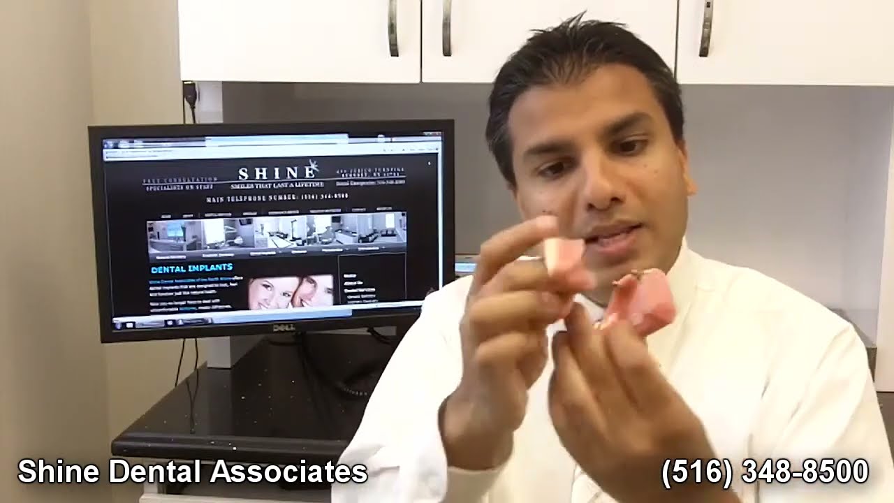 Mini Dental Implants - Denture Stabilization
