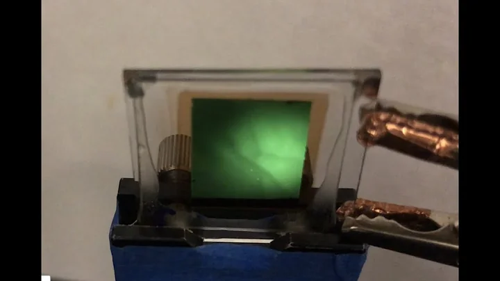 Infrared imager sees blood vessels