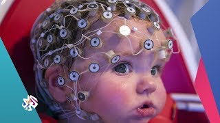 صباح النور│كيفية علاج كهرباء المخ الزّائدة لدى الأطفال