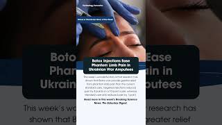 Botox Injections Ease Phantom Limb Pain in Ukrainian War Amputees