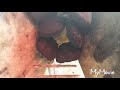 Middle of video