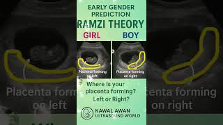  8 Weeks U0026 Already Guessing  Ramzi Theory Says  ultrasound