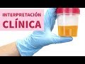 Examen general de orina: interpretación clínica