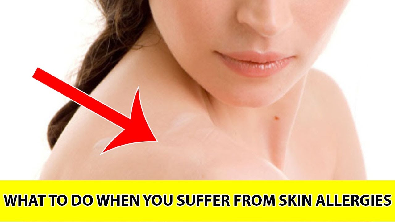 Skin allergies home remedies Mayo clinic HOME REMEDIES to Cure