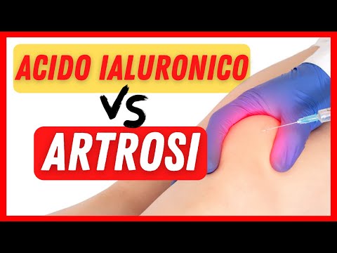 🟢 Infiltrazioni di ACIDO IALURONICO e ginocchio artrosico - Tutto quello che devi sapere❗❗