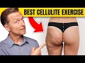 The Best Cellulite Exercise - Dr. Berg