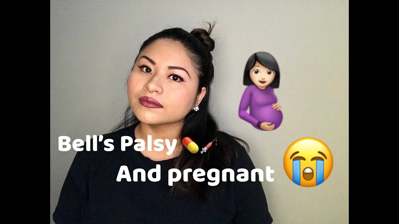 Bell's Palsy and pregnant YouTube