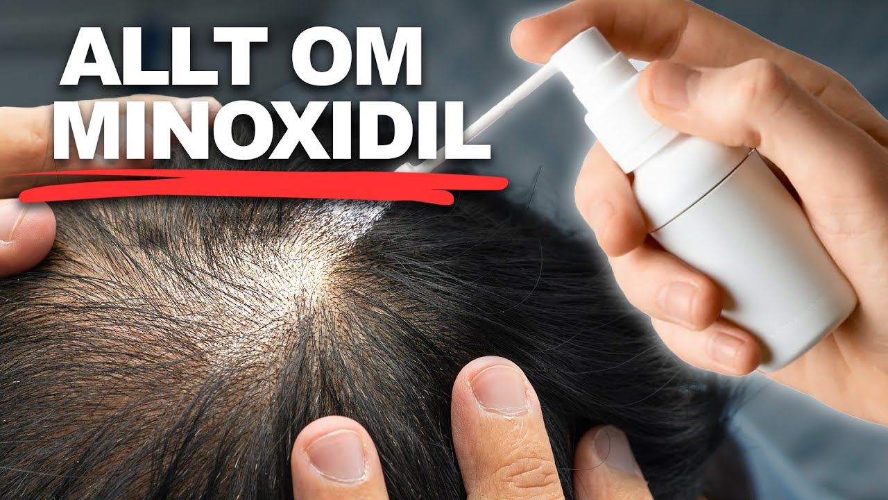 Allt DU MÅSTE veta om MINOXIDIL för HÅRAVFALL
