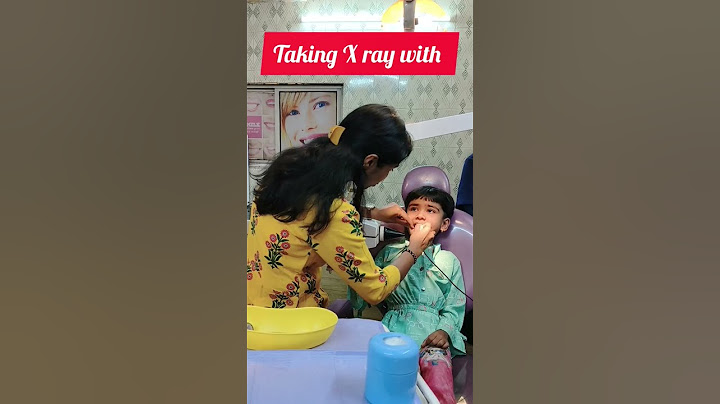 Bacho Ke Dant #shorts #trending #kids #teeth #viral #dental #youtubeshorts #dr #hindi