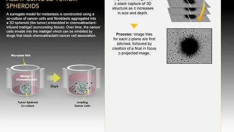 Label Free Tumor Invasion Assay Using 3D Tumor Spheroids Visual Abstract
