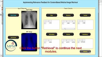 Implementing Relevance Feedback for Content Based Medical Image Retrieval | DIP - MATLAB