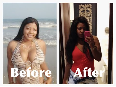 MY TRUTH PLASTIC SURGERY EXPERIENCE - YouTube