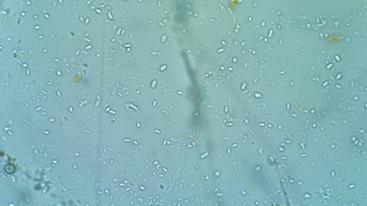 Household bleach vs bacteria and fungal spores. YouTube