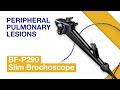 Olympus slim bronchoscope with radial EBUS miniprobe for peripheral lung diagnosis
