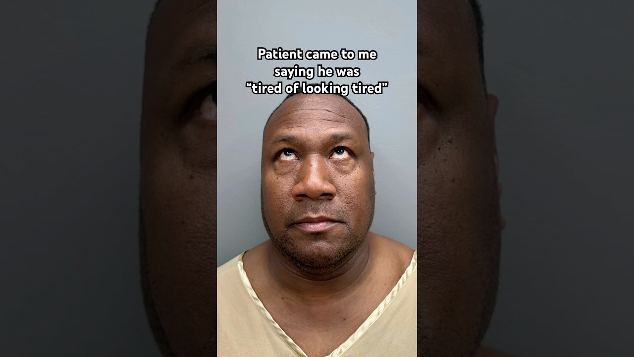 This Man Was Tired of Looking Tired! See How Much Younger He Looks After Surgery! 😱