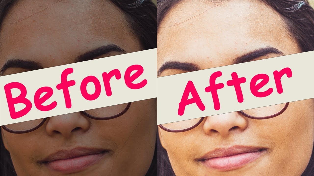 Permanent Magical and Fast Skin Whitening at home Naturally | Proven