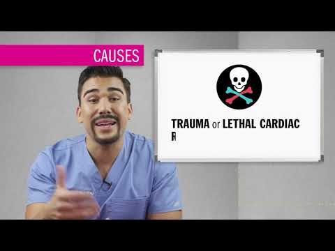 EKG l Asystole
