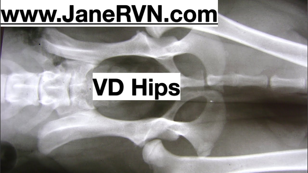 xray VD hips YouTube