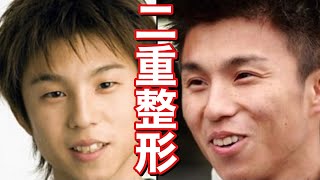 整形の件についてお話します