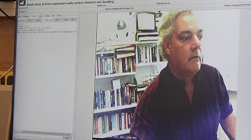 The Je Vois CNN camera