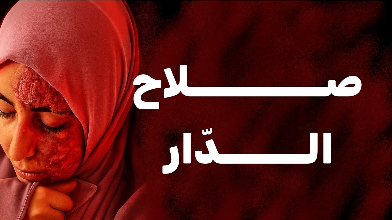 قصتي ....لقيت روحي فالشارع ومحروقة ومافهمتش كيفاش صرات !!! 