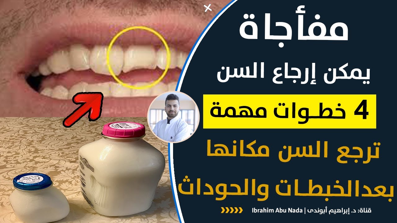 ماذا افعل اذا وقع سن ابني | الطريقة الصحيحة للتعامل مع السن المكسور |يمكن ارجاع السن |طريقة حفظ السن