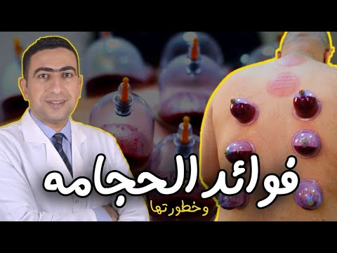 الحجامة فوائد وموانع وشروط
