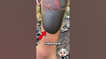 ถุงน้ำบนรอยสักคืออะไร? #สาระ #viral #shorts