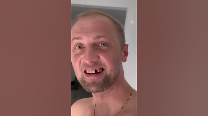 У ОТЦА ВЫПАДАЮТ ЗУБЫ  #shorts #отец #зубарев #зубоф