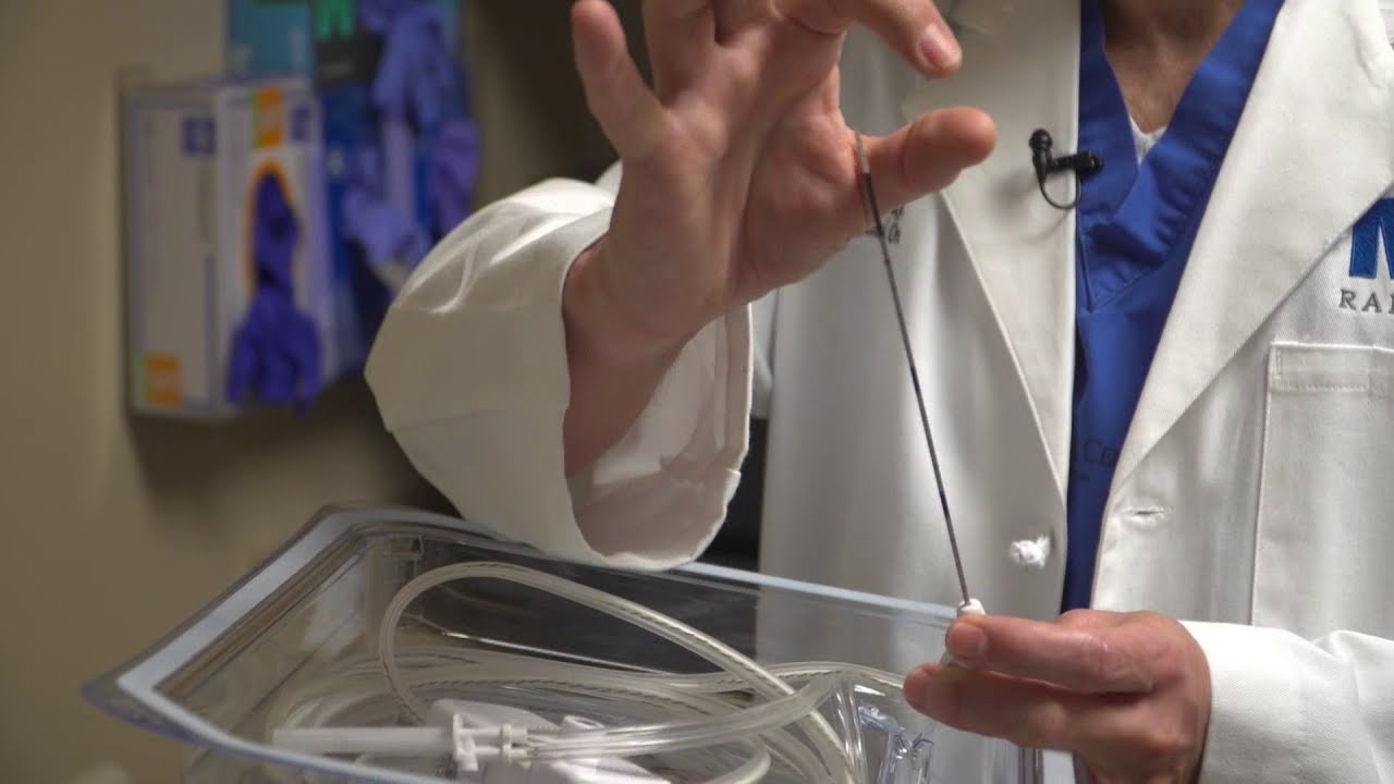 san antonio spurs roster Ablation procedure saves patient's kidney