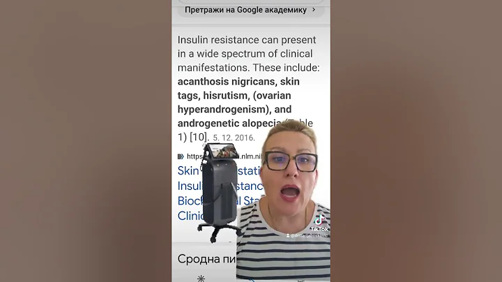 Da li zapoeti lasersku epilaciju ako imate insulin...