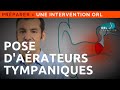 Information Patient | Pose d'aérateurs (diabolo) tympaniques - YouTube