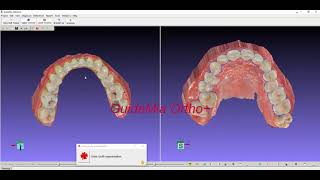 Ortho Design With Guidemia Orthoclic In 150 Seconds
