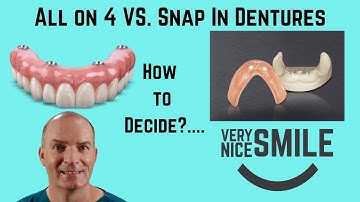 All on 4 or Snap in dentures? Some points to consider.