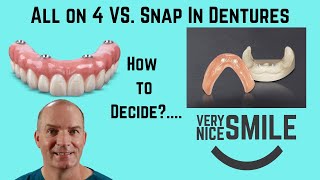 All on 4 or Snap in dentures? Some points to consider. by Very Nice Smile Dental 20,538 views 7 months ago 16 minutes