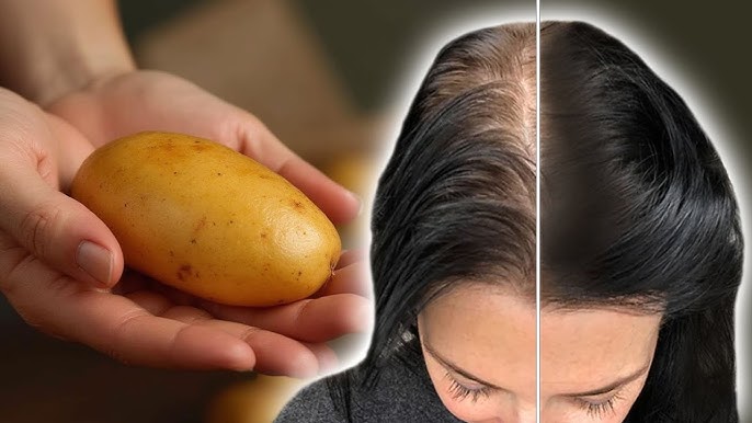 Hair grows like crazy and does not fall out! the most effective recipe! - YouTube