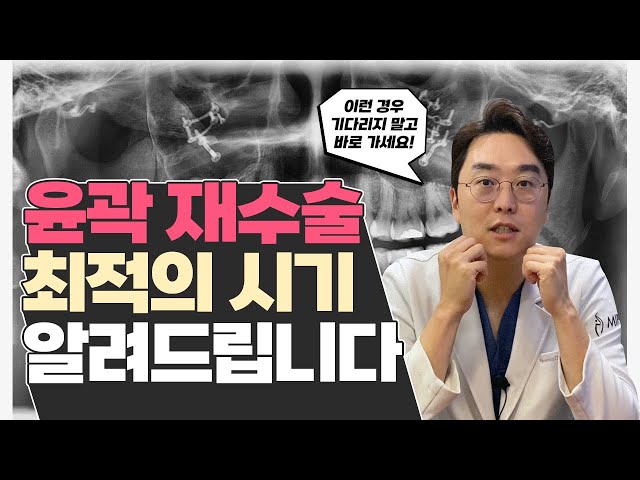 윤곽 재수술, 최적의 시기 알려드립니다!