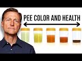 What Your URINE COLOR Says about Your Health