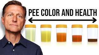 What Your Urine Color Says About Your Health