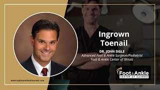 Ingrown Toenail | Dr. John Sigle | Foot & Ankle Center of Illinois