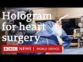 Hologram shows patient’s heart during surgery - BBC World Service