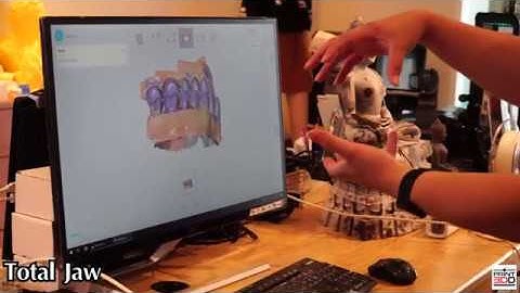 Shining3D Aoralscan scanning workflow
