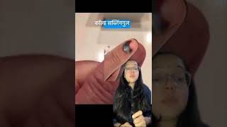 Black Spot Under Nail what Does It Mean Subungual Hematomal doctor hospital shorts