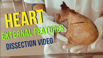 External features of the Heart| Dissection video